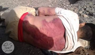 طالبان یک باشنده شهرستان عنابه را شکنجه کردند